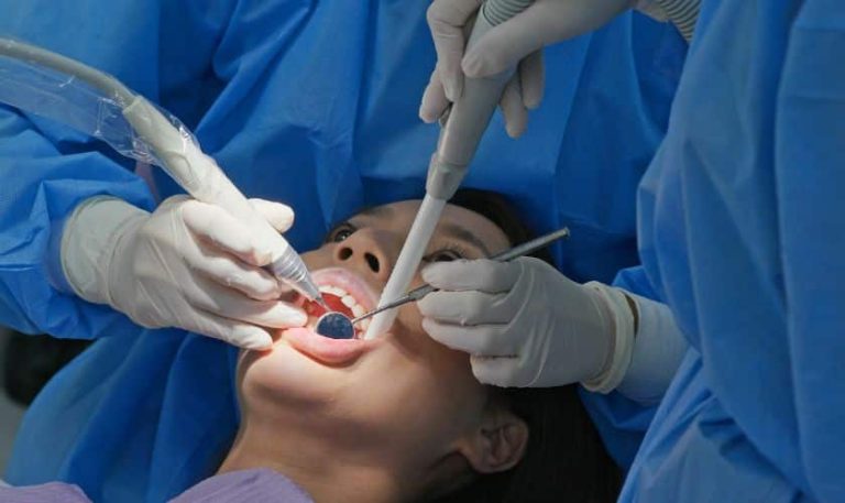 Benefits of Apicoectomy