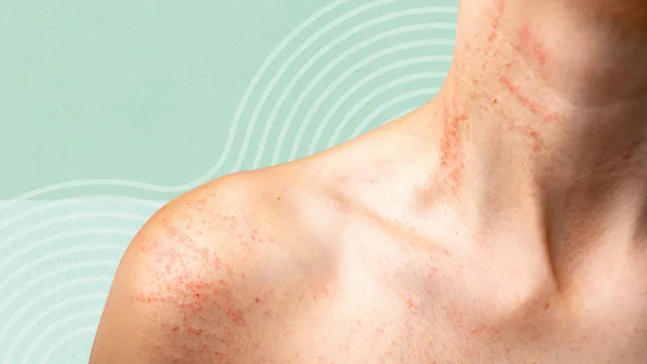 Common Skin Conditions: Causes, Symptoms, and Prevention Common Skin Conditions