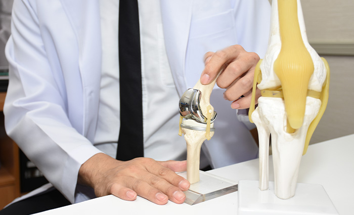 Advancements in Joint Replacement Surgery Joint Replacement