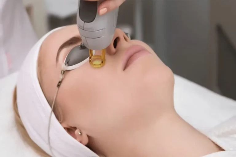 Laser Treatment