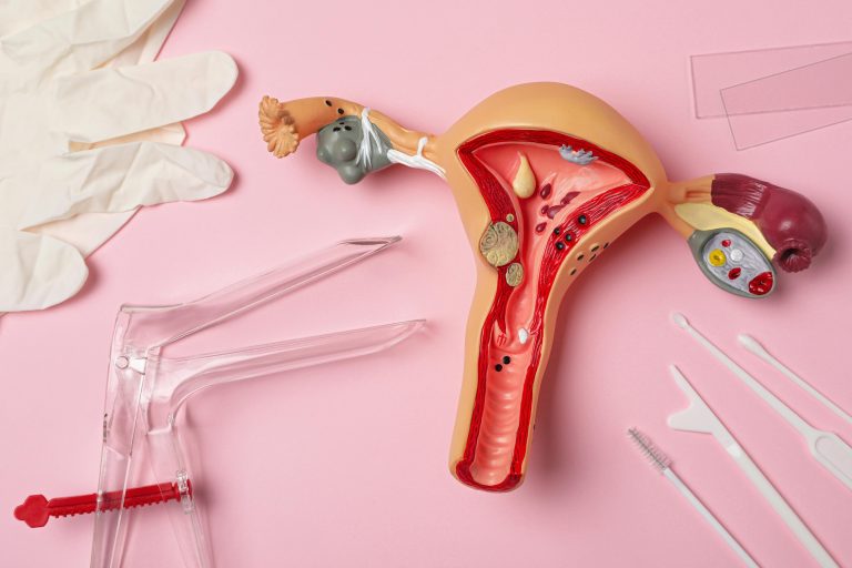 Role of Pap Smears With Your Gynecologist