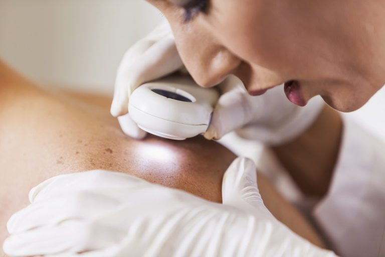 Early Signs of Skin Cancer and When to Seek Medical Advice Early Signs of Skin Cancer