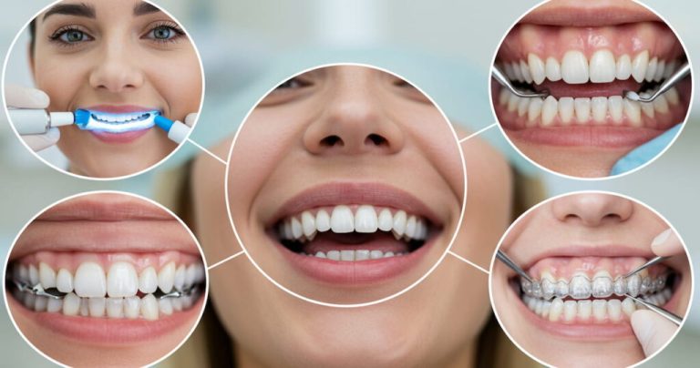Services in Cosmetic Dentistry