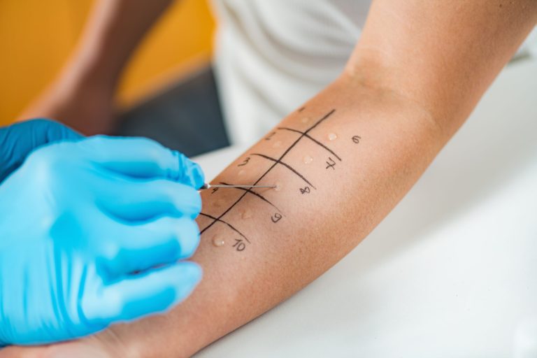 Regular Allergy Testing