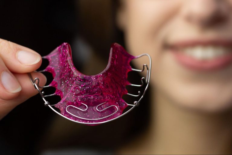 Retainers in Orthodontics