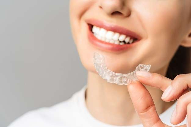 The Latest Innovations in Clear Braces Technology Clear Braces Technology