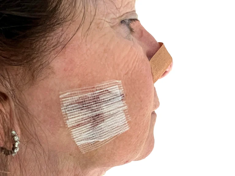 When Is Mohs Surgery Recommended Mohs Surgery