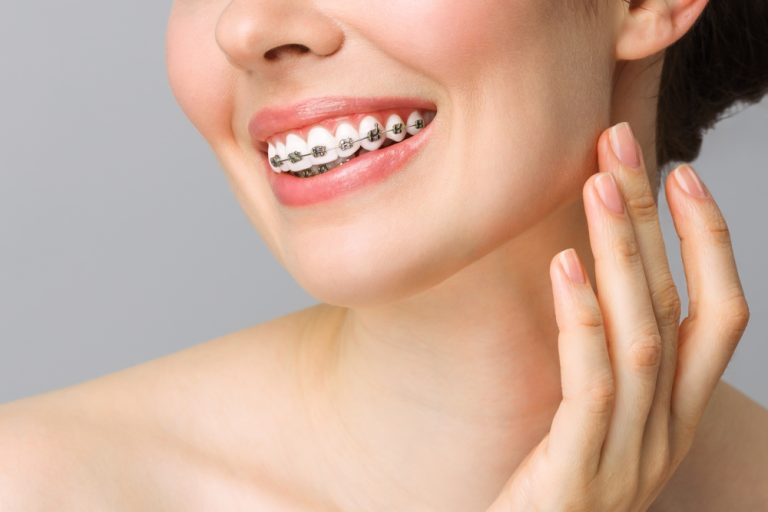 How Teeth Straightening Can Improve Your Oral Functionality Teeth Straightening