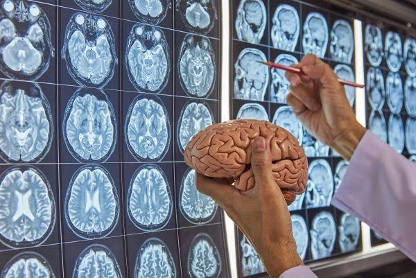 What To Know About Neurological Surgeons and Brain Surgery Neurological Surgeons and Brain Surgery