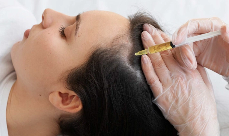 The Role of Platelets in PRP for Hair Loss PRP for Hair Loss